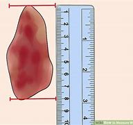 Image result for How to Measure Wound Size