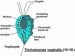 Image result for Trichomoniasis in Eye