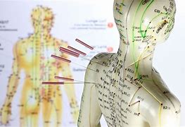 Image result for Types of Acupuncture