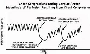 Image result for Recover CPR Drug Chart