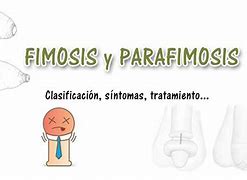 Image result for fimosis