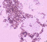 Image result for HEK293T Cells