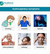 Image result for Normotensive Hydrocephalus Signs