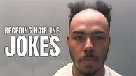 Image result for Funniest Hair Lines
