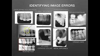Image result for Unprocessed Dental Film