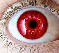 Image result for Red Iris Eye Color