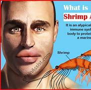Image result for Fish Allergy Symptoms Adults