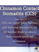 Image result for Cinnamon Allergy
