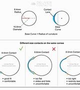 Image result for What Is BC Contact Lenses