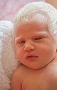 Image result for Baby Born with White Hair