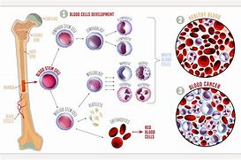 Image result for Leukemia Cell Structure