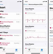 Image result for Af ECG Apple Watch