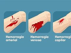 Image result for hemorragia