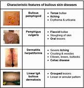 Image result for Petechiae Leukemia Symptoms