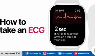 Image result for Apple Watch EKG