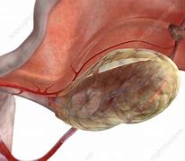 Image result for Real Human Ovary