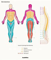 Image result for Lumbar Nerve Dermatome Chart