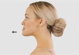 Image result for Protruding Lower Jaw