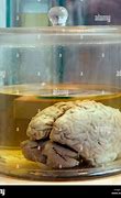 Image result for Preserved Human Brain