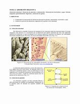 Image result for absorci�mstro