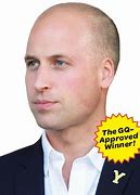 Image result for Prince William Bald with Beard