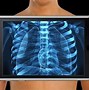 Image result for iPhone X-ray App