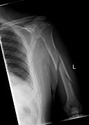 Image result for Arm X-ray