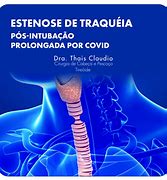 Image result for traqueo