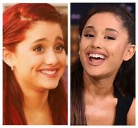 Image result for Ariana Grande Grillz Teeth