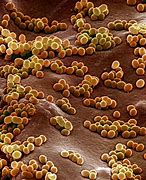 Image result for Staphylococcus Aureus