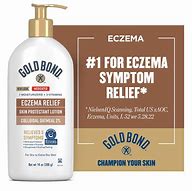 Image result for Eczema Relief Lotion