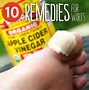 Image result for Wart Remedy
