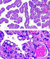 Image result for Choroid Plexus Histology