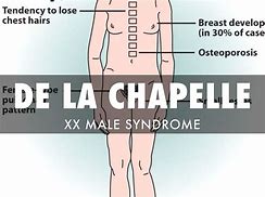 Image result for De La Chapelle Syndrome Symptoms