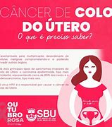 Image result for colo�o