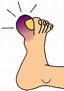 Image result for Broken Foot Clip Art