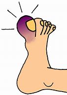 Image result for Broken Foot Clip Art Humor