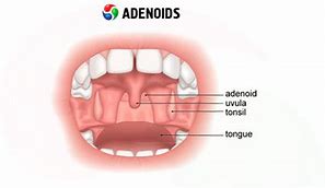 Image result for adeniso