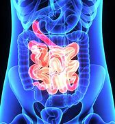 Image result for intestinal