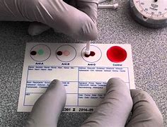 Image result for How to Test Blood Type