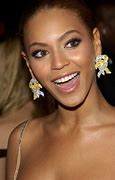 Image result for Beyonce's Teeth