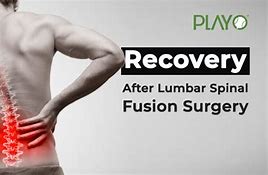 Image result for Back Brace After Lumbar Fusion Surgery