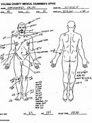 Image result for Dale Earnhardt Autopsy