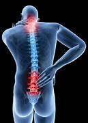 Image result for Chiropractic Images. Free