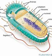 Image result for Picture of Archaebacteria