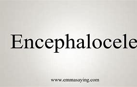 Image result for Encepholoceles