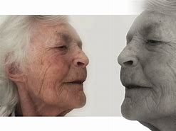 Image result for Alzheimer's Eyes
