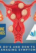 Image result for 6 Cm Fibroids in Uterus