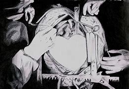 Image result for Heart Surgery Cartoon