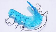 apparecchio mobile apparecchio denti lo strumento migliore per ottenere un apparecchio mobile apparecchio denti lo strumento migliore per ottenere un
